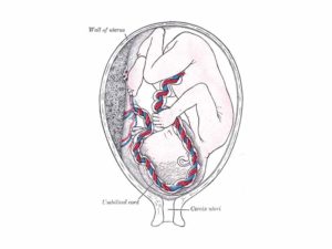 Fig. 4. The interior of the human womb, taken from Henry Gray’s Anatomy of the Human Body, published in 1918. This is his Figure 38, titled “Fetus in utero, between fifth and sixth months.”